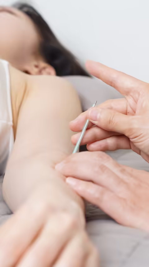 Acupuntura Medicinal